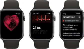 Apple Watch EKG uygulaması nasıl kullanılır: Kalp sağlığınızı takip edin