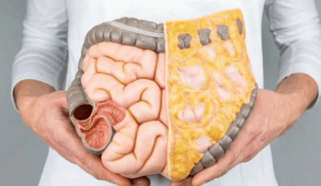 Rektum Kanseri: Belirtiler, Nedenleri ve Tedavi Süreci