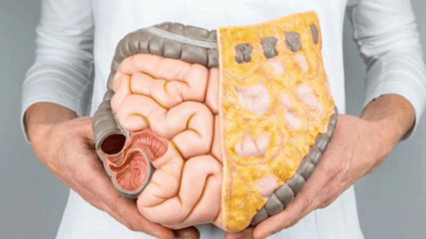 Rektum Kanseri: Belirtiler, Nedenleri ve Tedavi Süreci